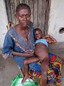 3 Mother with her boy who was contaminated with monkey pox